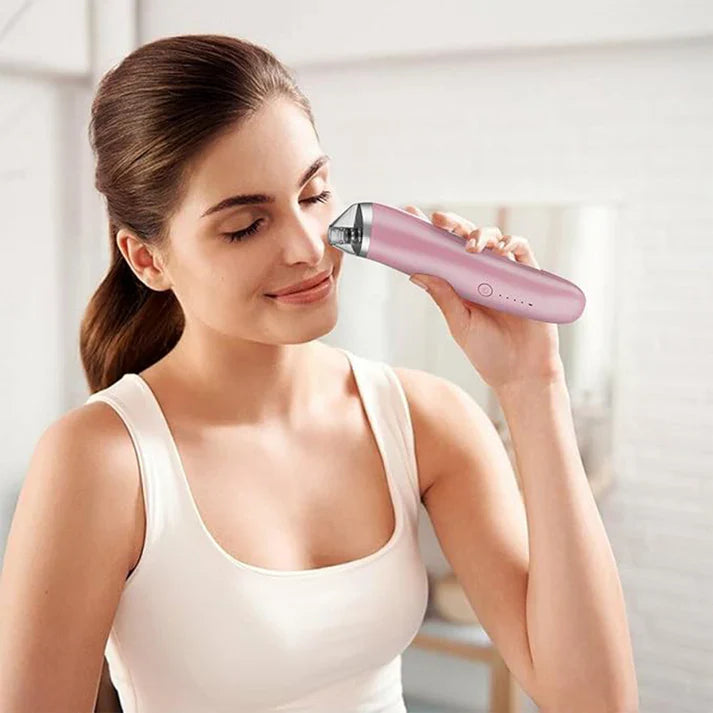 Zentheca – Electric Blackhead Remover