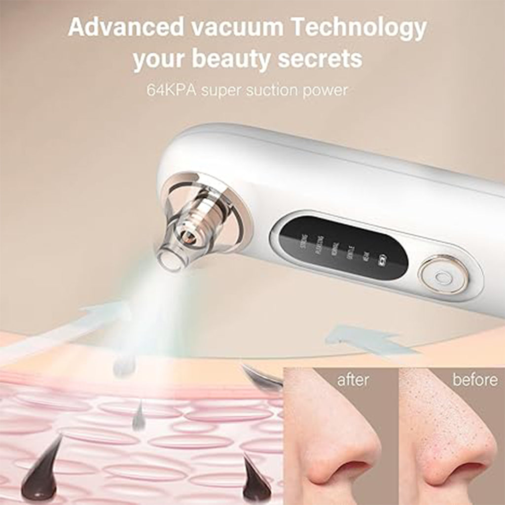 Zentheca – PureLift Pore Extractor