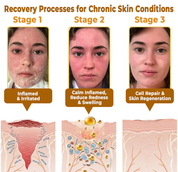 BeeRx™ Natural Bee Venom Cream